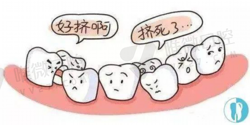 关于六龄齿窝沟封闭的建议(图1)